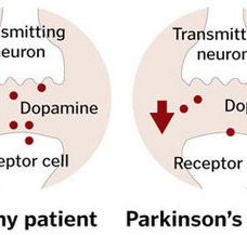 parkinsons-dopamine