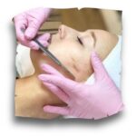 dermaplaning