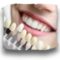 teethwhitening for website thumbnail