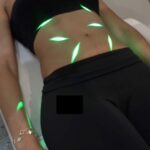 Green Light Lipo